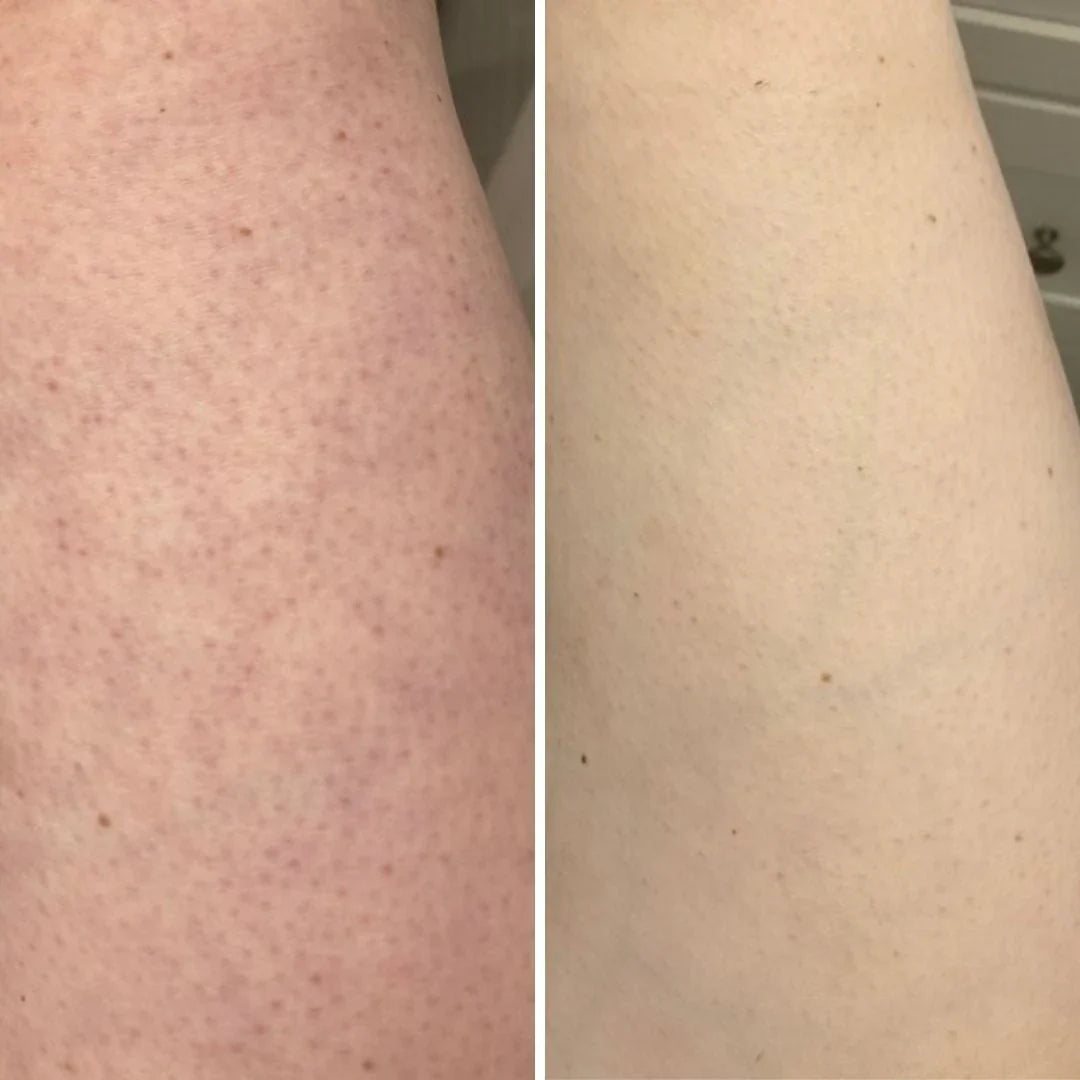 WilderWay Instant Cover & Care Cream Stick